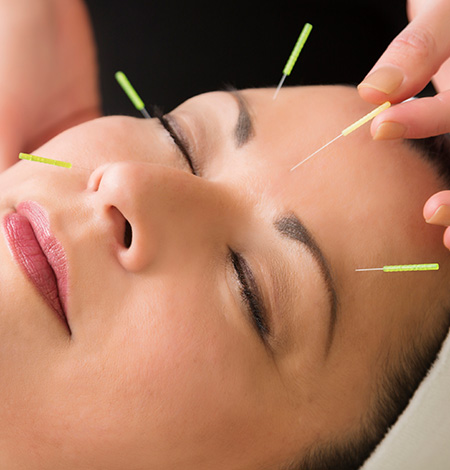 Acupuncture clinic in vellore